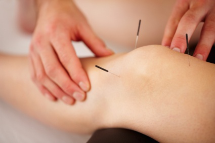 Dry Needling 2